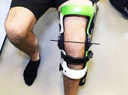 Knee Braces: A Comprehensive Guide on Usage and Maintenance